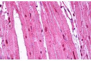 Anti-RRAS antibody IHC staining of human heart.