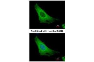 ICC/IF Image Immunofluorescence analysis of methanol-fixed HeLa, using ARF3, antibody at 1:500 dilution.