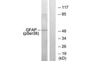 Western blot analysis of extracts from HeLa cells, using GFAP (Phospho-Ser38) Antibody. (GFAP anticorps  (pSer38))