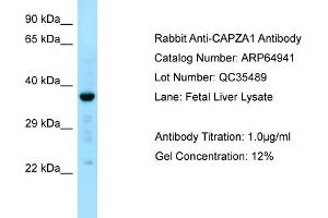 Western Blotting (WB) image for anti-Capping Protein (Actin Filament) Muscle Z-Line, alpha 1 (CAPZA1) (N-Term) antibody (ABIN2790000) (CAPZA1 anticorps  (N-Term))