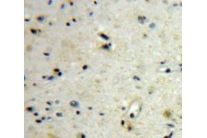 Used in DAB staining on fromalin fixed paraffin-embedded Brain tissue (CGB anticorps  (AA 31-165))
