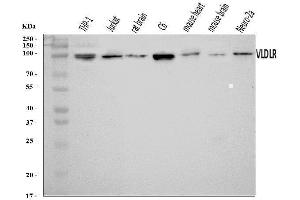 Western blot analysis of VLDL Receptor/VLDLR using anti-VLDL Receptor/VLDLR antibody (ABIN7600777).