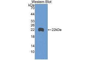 Western Blotting (WB) image for anti-Growth Arrest and DNA-Damage-Inducible, beta (GADD45B) (AA 1-160) antibody (ABIN2116595) (GADD45B anticorps  (AA 1-160))