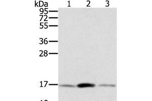 Western Blot analysis of Hela, hepg2 and PC3 cell using PPIA Polyclonal Antibody at dilution of 1:300 (PPIA anticorps)