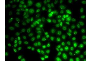 Immunofluorescence analysis of HeLa cells using PRMT2 antibody (ABIN6127447, ABIN6146227, ABIN6146228 and ABIN6221530). (PRMT2 anticorps  (AA 1-300))