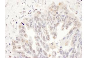 anti-Deoxycytidine Kinase (DCK) (AA 210-260) antibody