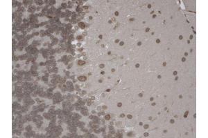 Immunohistochemistry analysis using Mouse Anti-TrpM7 Monoclonal Antibody, Clone S74-25 .