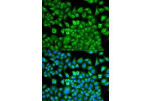 Immunofluorescence analysis of MCF-7 cells using FABP1 antibody.