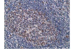 Image no. 5 for anti-Synovial Sarcoma, X Breakpoint 1 (SSX1) antibody (ABIN1501156) (SSX1 anticorps)