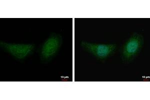 ICC/IF Image Fumarate hydratase antibody detects Fumarate hydratase protein at mitochondria by immunofluorescent analysis.