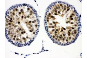 IHC testing of FFPE mouse testis with Cdk2 antibody.