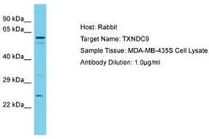 Image no. 1 for anti-Thioredoxin Domain Containing 9 (TXNDC9) (N-Term) antibody (ABIN6750580) (TXNDC9 anticorps  (N-Term))