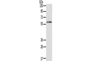 Gel: 8 % SDS-PAGE, Lysate: 40 μg, Lane: Human placenta tissue, Primary antibody: ABIN7191225(KLHL8 Antibody) at dilution 1/200, Secondary antibody: Goat anti rabbit IgG at 1/8000 dilution, Exposure time: 10 seconds (KLHL8 anticorps)