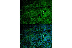 Immunofluorescence analysis of HeLa cells using TRIM13 antibody (ABIN5973665). (TRIM13 anticorps)