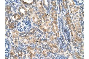 CDH3 antibody was used for immunohistochemistry at a concentration of 4-8 ug/ml to stain Epithelial cells of renal tubule (arrows) in Human Kidney. (P-Cadherin anticorps)