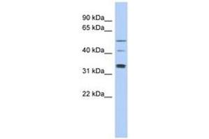 Image no. 1 for anti-T-Complex 11, Testis-Specific (TCP11) (AA 143-192) antibody (ABIN6743759) (TCP11 anticorps  (AA 143-192))