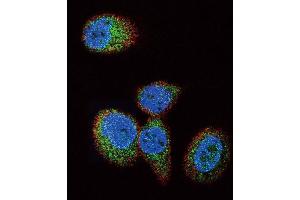 Immunofluorescence (IF) image for anti-HRas proto-oncogene, GTPase (HRAS) antibody (ABIN3003478) (HRAS anticorps)