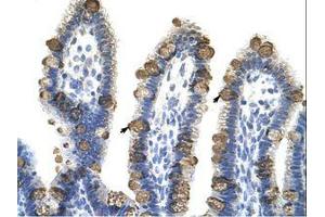 Image no. 1 for anti-Exosome Component 3 (EXOSC3) (AA 81-130) antibody (ABIN6736236)