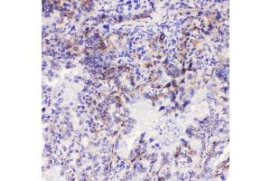 IHC analysis of Integrin alpha 3 using anti-Integrin alpha 3 antibody (ABIN6719410). (ITGA3 anticorps)