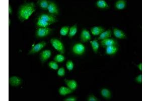 Immunofluorescence staining of A549 cells with ABIN7169324 at 1:133, counter-stained with DAPI.