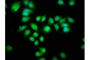 Immunofluorescence staining of A549 cells with ABIN7169324 at 1:133, counter-stained with DAPI. (AANAT anticorps  (AA 1-207))