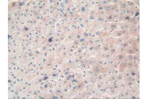IHC-P analysis of Human Liver Tissue, with DAB staining. (TTR anticorps  (AA 21-147))