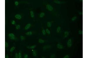 Anti-ALDH1L1 mouse monoclonal antibody (ABIN2452748) immunofluorescent staining of COS7 cells transiently transfected by pCMV6-ENTRY ALDH1L1 (RC213720). (ALDH1L1 anticorps)