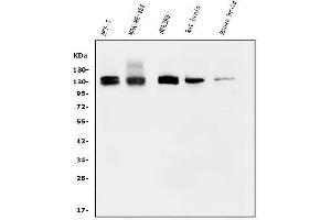 Western blot analysis of KIBRA/WWC1 using anti-KIBRA/WWC1 antibody (ABIN7602724). (WWC1 anticorps  (AA 990-1080))