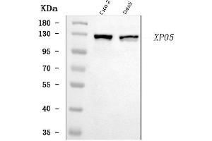 Western blot analysis of Exportin-5/XPO5 using anti-Exportin-5/XPO5 antibody (ABIN7598950).