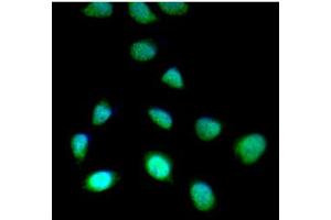 ICC/IF analysis of SET7/9 in HeLa cells line, stained with DAPI (Blue) for nucleus staining and monoclonal anti-human SET7/9 antibody (1:100) with goat anti-mouse IgG-Alexa fluor 488 conjugate (Green). (SET7/9 anticorps)