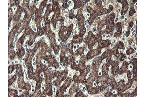 Image no. 12 for anti-Ubiquitin-Conjugating Enzyme E2, J1, U (UBE2J1) antibody (ABIN1501638)