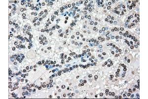 Image no. 2 for anti-B-Raf proto-oncogene, serine/threonine kinase (BRAF) antibody (ABIN1496951)