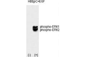 Western Blotting (WB) image for anti-Mitogen-Activated Protein Kinase 1/3 (MAPK1/3) (pThr202), (pTyr204) antibody (ABIN3001885)