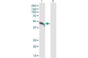 Western Blot analysis of MAP2K2 expression in transfected 293T cell line by MAP2K2 monoclonal antibody (M11), clone 8D10.