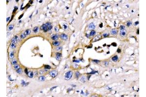 IHC analysis of PAR-3/PARD3 using anti-PAR-3/PARD3 antibody (ABIN7598983).