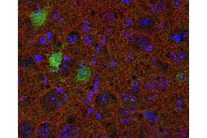 Indirect immunolabeling of PFA fixed mouse cortex section with anti-SV2 B (dilution 1 : 200; red) and guinea pig anti-calbindin (, dilution 1 : 200; green).