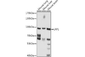 Western blot analysis of extracts of various cell lines, using LRP1 Rabbit pAb (ABIN6130085, ABIN6143323, ABIN6143324 and ABIN6217535) at 1:1000 dilution. (LRP1 anticorps  (AA 20-270))