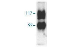 Western blot analysis of Slc14a2 in rat kidney (inner medulla) with Slc14a2 polyclonal antibody  at 1:1000 dilution. (Solute Carrier Family 14 (Urea Transporter, Kidney) Member 2 (SLC14A2) (AA 911-929) anticorps)