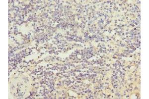 Immunohistochemistry of paraffin-embedded human spleen tissue using ABIN7156852 at dilution of 1:100 (IL21 Receptor anticorps  (AA 20-240))