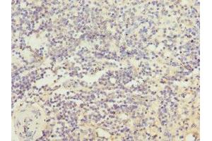 Immunohistochemistry of paraffin-embedded human spleen tissue using ABIN7156852 at dilution of 1:100