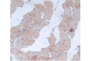 Detection of IL24 in Rat Skin Muscle Tissue using Monoclonal Antibody to Interleukin 24 (IL24) (IL-24 anticorps  (AA 29-183))