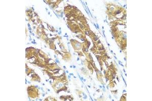 Immunohistochemistry of paraffin-embedded human stomach using NME3 antibody (ABIN3016659, ABIN3016660, ABIN3016661 and ABIN6219806) at dilution of 1:100 (40x lens). (NME3 anticorps  (AA 20-169))