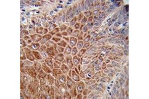 IHC analysis of FFPE human skin stained with IGH antibody (IgH anticorps  (AA 290-320))