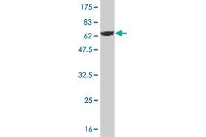 Western Blot detection against Immunogen (62. (DCPS anticorps  (AA 1-337))