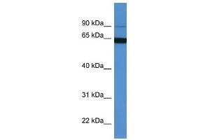 Western Blot showing MAP6 antibody used at a concentration of 1-2 ug/ml to detect its target protein. (MAP6 anticorps  (N-Term))