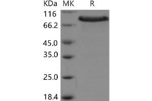 Western Blotting (WB) image for Cysteine-Rich with EGF-Like Domains 1 (CRELD1) protein (Fc Tag,ECD) (ABIN7195349)