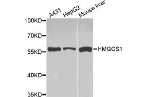 Western Blotting (WB) image for anti-3-Hydroxy-3-Methylglutaryl-CoA Synthase 1 (Soluble) (HMGCS1) (AA 241-520) antibody (ABIN6220423) (HMGCS1 anticorps  (AA 241-520))