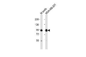 All lanes : Anti-EZH2 Antibody at 1:2000 dilution Lane 1: mouse testis lysates Lane 2: MDA-MB-231 whole cell lysates Lysates/proteins at 20 μg per lane.
