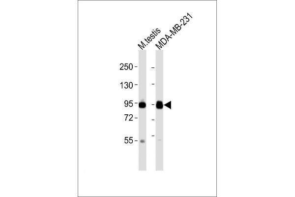 EZH2 anticorps  (N-Term)