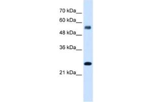 Western Blotting (WB) image for anti-SMAD, Mothers Against DPP Homolog 1 (SMAD1) antibody (ABIN2461768) (SMAD1 anticorps)